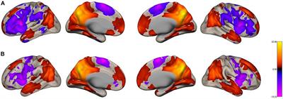 The Precuneus Contributes to Embodied Scene Construction for Singing in an Opera